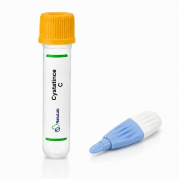 Cystatine C - Vingerprik