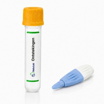 Bloedtest Ontstekingen -...