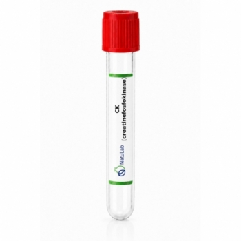 CK (creatinefosfokinase)