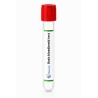 Bloedbeeld basis - laboratoriumtest