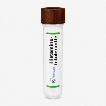 Histamine-intolerantie